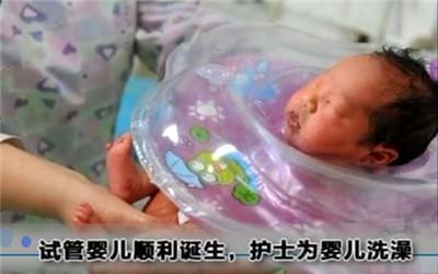 多囊卵巢案例